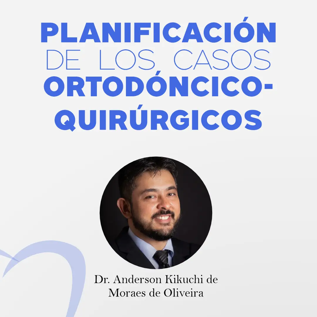 Planificación de los casos Ortodóncico-Quirúrgicos